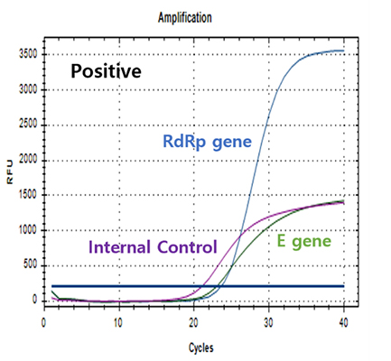 ZooplexⓇ--SARS-CoV-2-V1-kit-(RUO).jpg